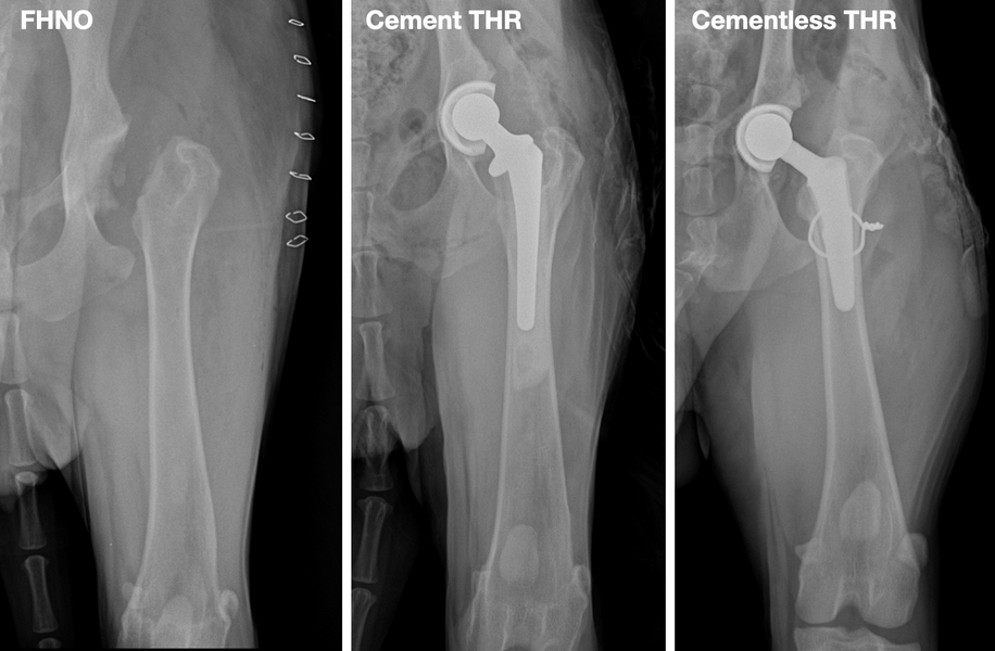 Total Hip Replacement – BioMedtrix